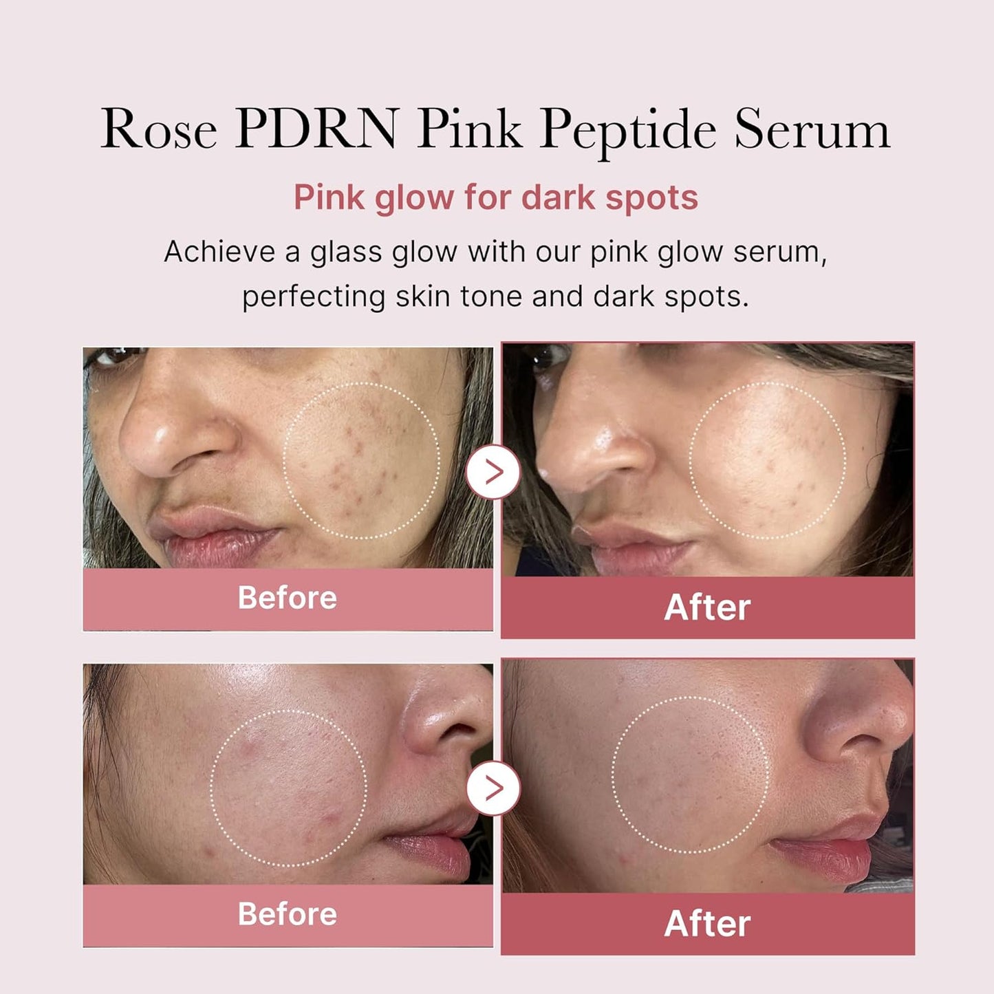 Medicube PDRN Pink Peptide Serum 30 ML